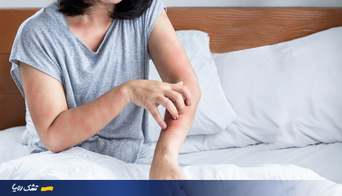 نابودی ساس تشک